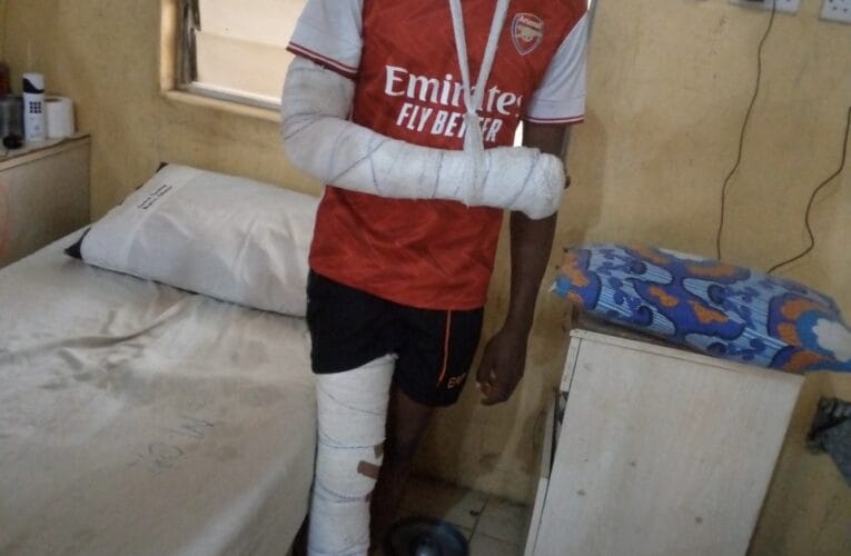 Oyo Youth Parliament member, J’Icon Ojo shows gratitude to God for surviving fatal accident 