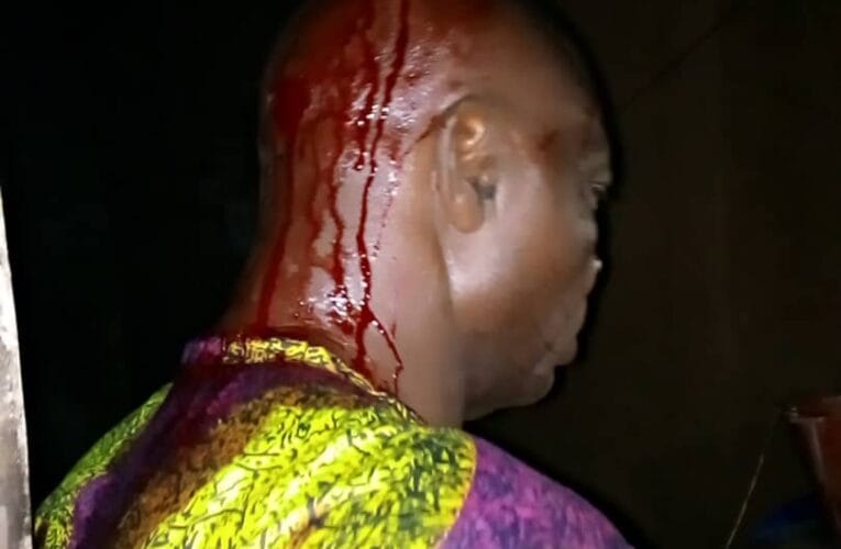 PHOTOS: Hon Yemi Taiwo’s Driver, 3 Others Injured As Suspected APC Thugs Attack PDP Supporters In Lanlate