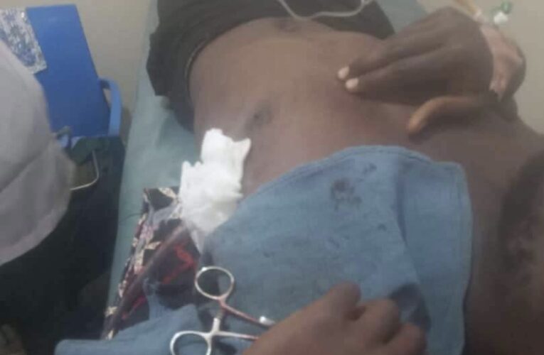 PHOTOS: UNIJOS student fighting for life after being stabbed by female neighbour for ‘making noise’