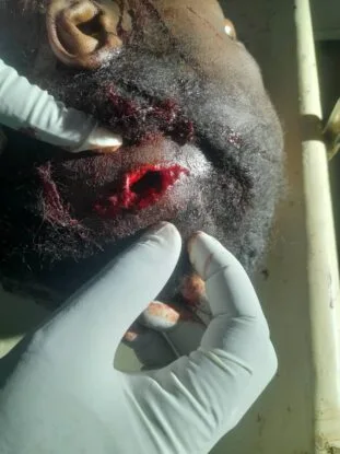 PHOTO: UNIMAID Student Attacks 21-yr-old Lady For Rejecting Love Proposal 