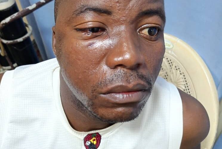 PHOTOS: OYRTMA Officers Attacked By Tricycle Riders in Ibadan