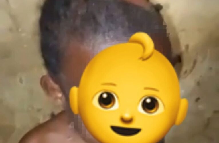 Police Arrest Two For Physically Abusing Five-Year-Old (Graphic Pictures) 