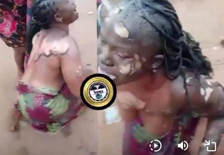 Husband Sets Wife Ablaze In Anambra Over Suspicion Of Infidelity
