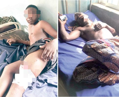 Boy Escapes Death On Father’s Bike After Erroneous Shot By Night Guard In Ibadan 