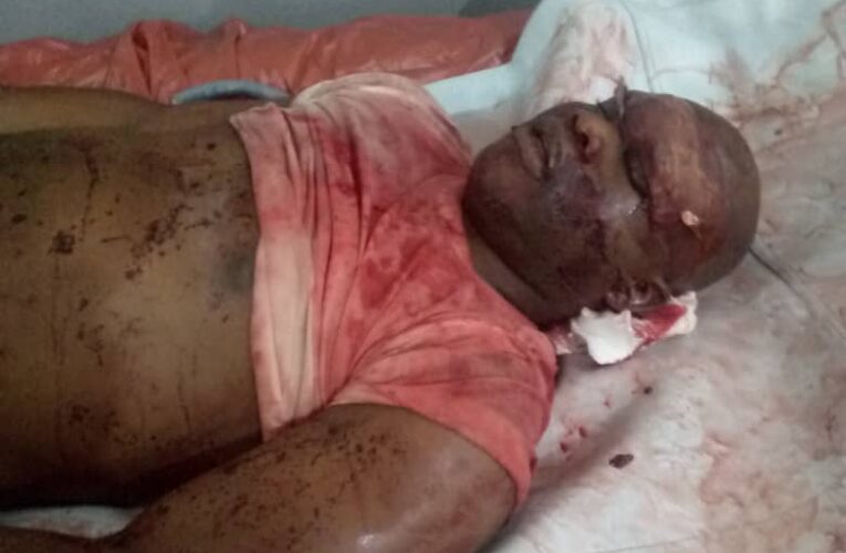 JUST IN: Amotekun Officer Killed In Alleged Attack By Soldier (Graphic)