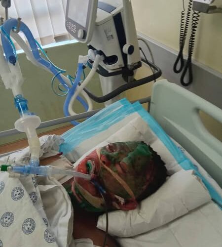 21-year Lady Apologises To Her Mom Before She D!ed After Being Set Ablaze