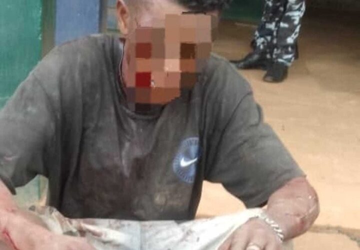 20-yr-old man found with human leg escapes mob attack in Oyo 