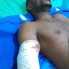 Worker Receives N25m Compensation After Losing Arm In Lagos Factory Accident